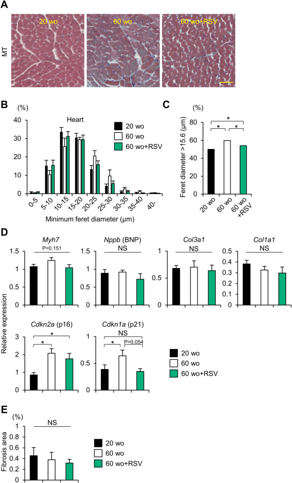 Phân tích nghiên cứu: Resveratrol hỗ trợ giảm thiểu chứng mất cơ và phì đại tim theo cách nào 3 1 s2.0 S1347861323000221 gr2