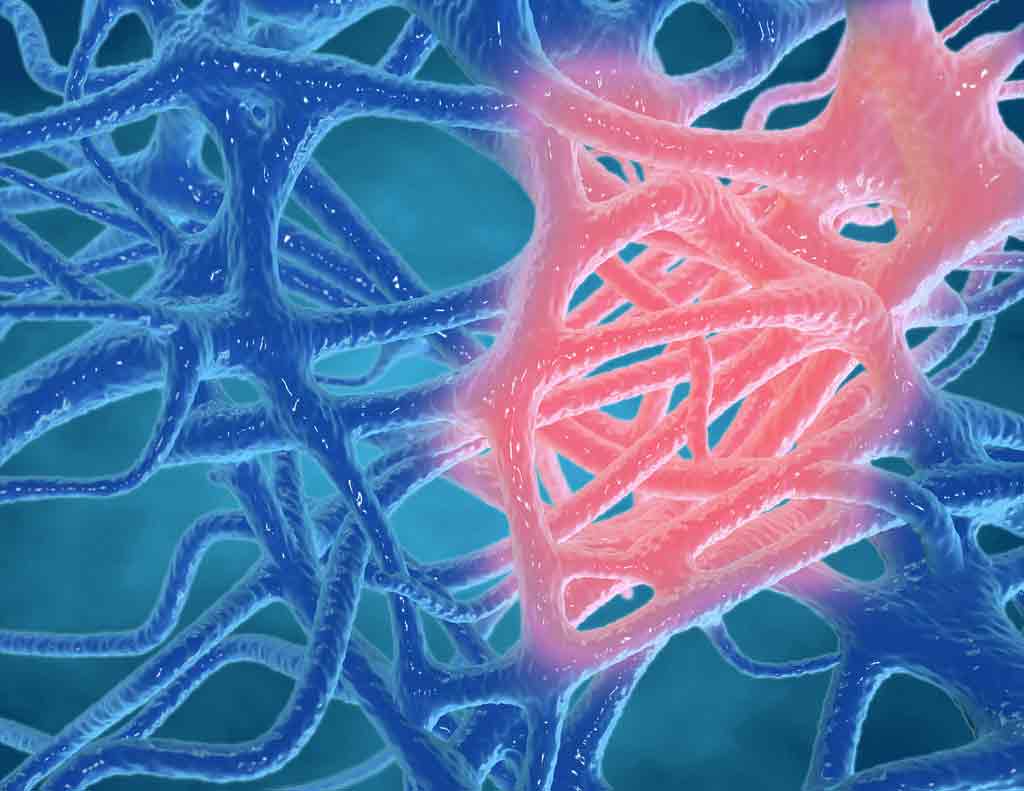 Quercetin là gì? Hướng dẫn năm 2023 4 inflammation