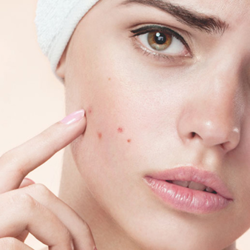 nguyen-nhan-gay-ra-mun-tham