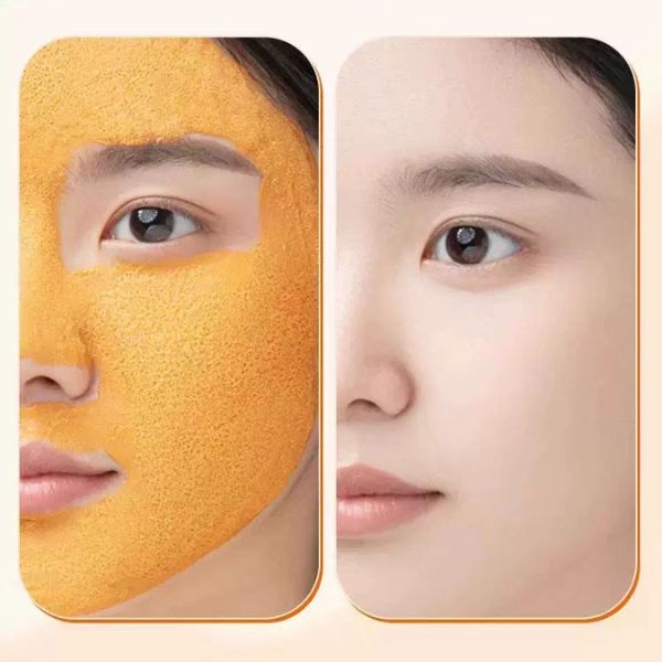 mat na ca rot sui bot 1