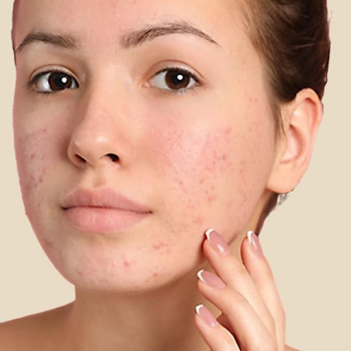 giam-cac-van-de-ve-mun