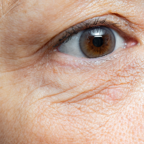 Bí quyết cách uống hạt chia đẹp da tự nhiên và hiệu quả 10 giup-giam-nep-nhan